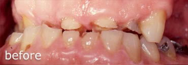 Before treatment